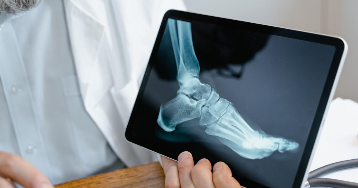 Small Signs, Smarter Care: Diabetic Foot Care in Statesboro, GA